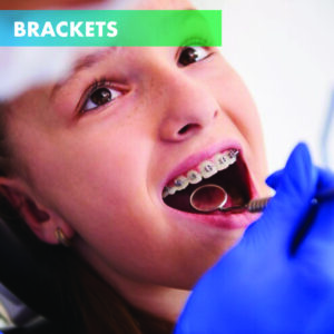 Gran variedad de Brackets