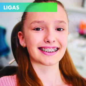 Ligas para ortodoncia